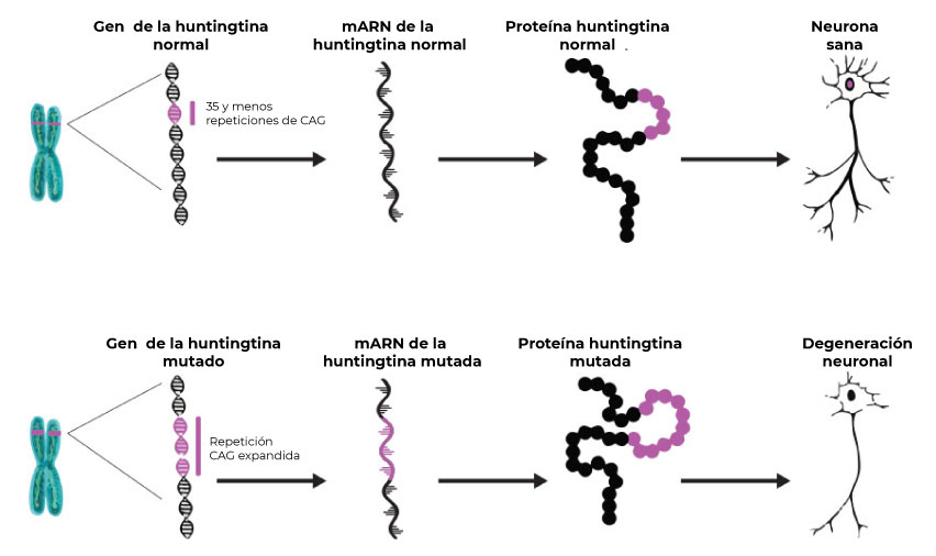 Image Enfermedad de Huntington
