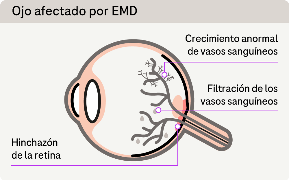 Oftalmología