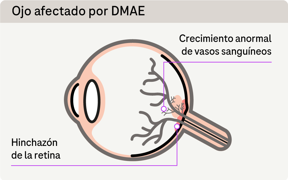 Oftalmología